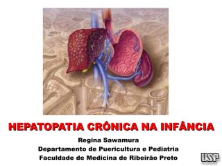 Hepatopatia crônica.pdf
